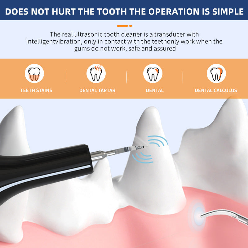 Ultrasonic Pet Teeth Cleaning Device - Premium Oral Care Tool - Woofcuties
