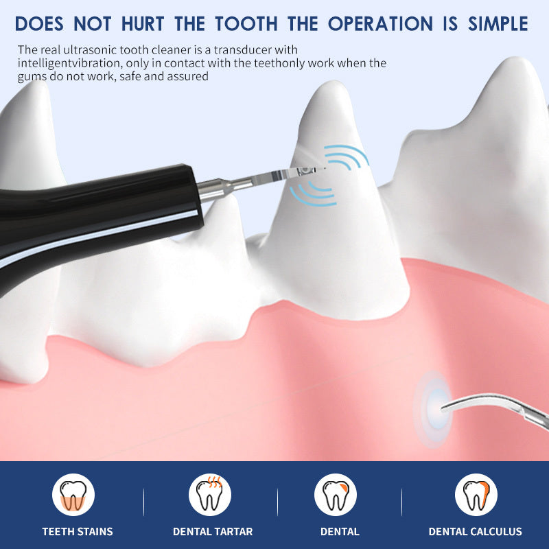 Ultrasonic Pet Teeth Cleaning Device - Premium Oral Care Tool - Woofcuties